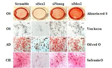 RNA 간섭에 의한 중간엽 줄기세포의 분화능력 변화.