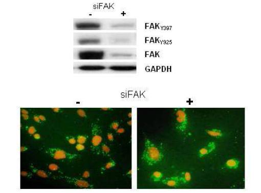 siFAK를 이용한 FAK의 발현 확인