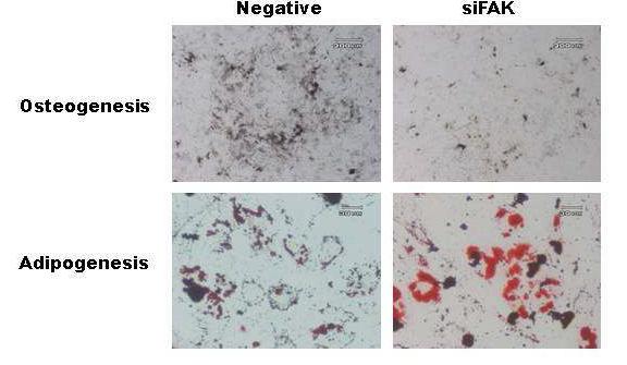 중간엽 줄기세포의 지방세포와 골아세포로 분화기간동안 FAK의 억제에 따른 분화력 측정