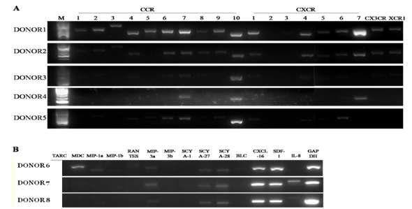 RT-PCR을 통한 (A) chemokine수용체 유전자 및 (B) chemokine유전자의 발현 관찰