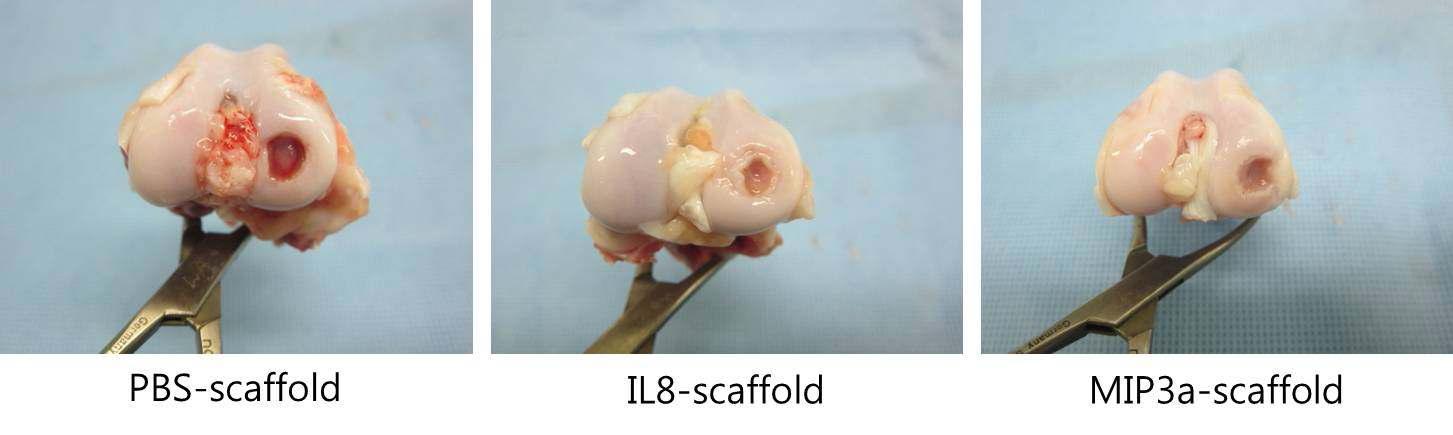 비글 무릎의 골관절염 모델에서 초기 관절연골 재생 촉진
