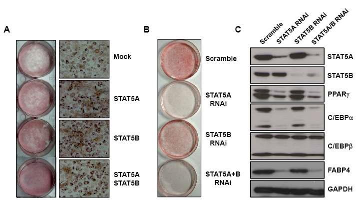 지방세포 분화기간동안 STAT5A, STAT5B의 과발현과 억제를 통한 분화 측정 및 유전자 발현 관찰