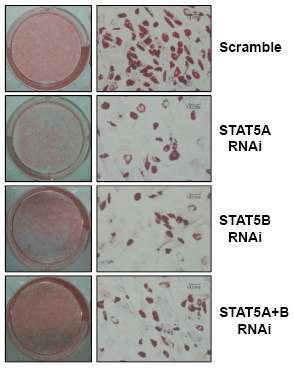 중간엽 줄기세포의 지방세포 분화기간동안 STAT5A와 STAT5B의 발현 억제