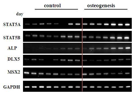 골아세포 분화기간 중 STAT5A,STAT5B와 골 분화 관련 유전자 발현 변화