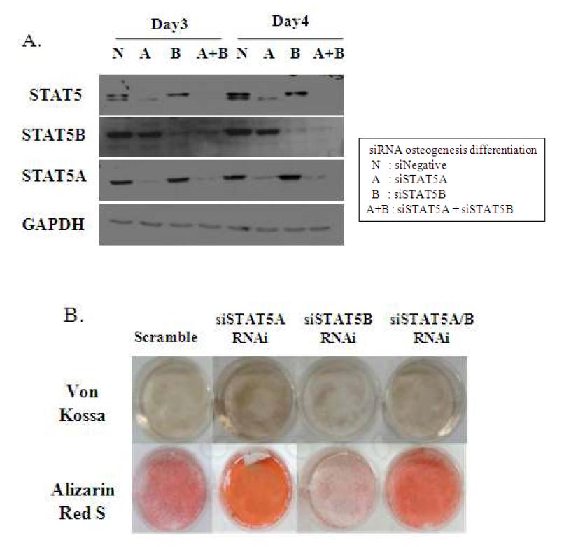 siRNA를 이용한 골 분화기간동안 STAT5A와 STAT5B의 역할