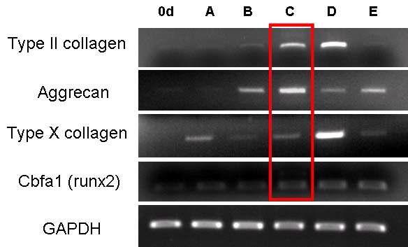 연골세포 분화시 제 2형 교원질과 골아세포관련 유전자의 발현 및 최적 분화법