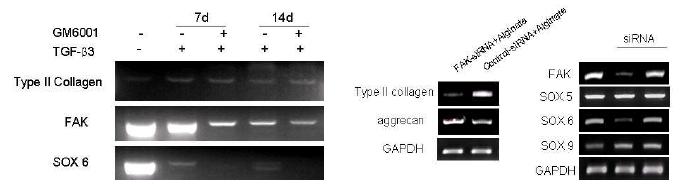 MMP 및 FAK억제에 의한 연골세포 분화시 유전자 발현