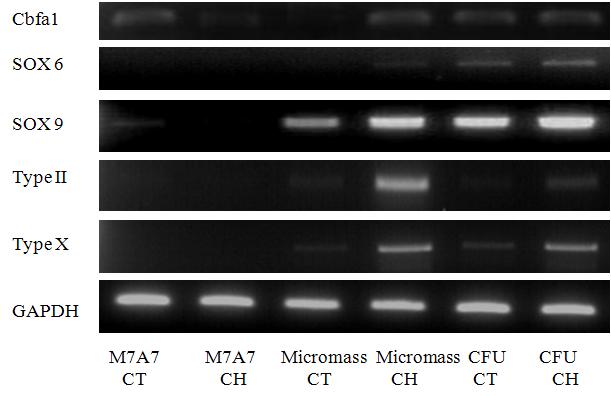 가지의 연골분화 방법을 통한 10일간의 배양 후 발현되는 연골분화 특이적 marker 유전자의 RT-PCR 결과