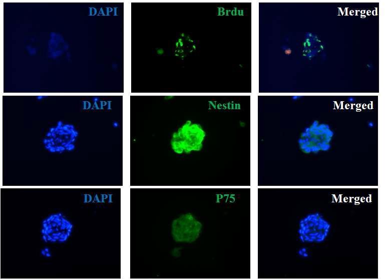 Neural stem cell 배양 7일 시 형성된 spheroid를 고정 및 세포형광 면역 염색하여 spheroid특성을 분석하였음. Spheroids는 BrdU+한 증식하는 세포들로 구성되었고 형성된 spheroids는 Nestin과 P75을 발현하였음(x400).
