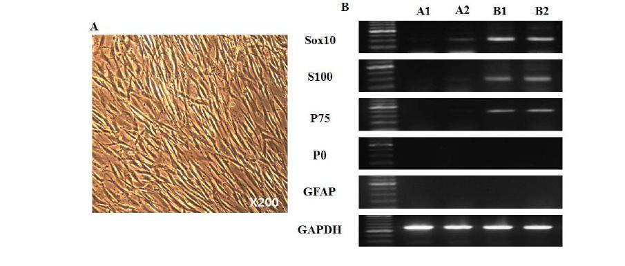 (A) 인체 지방조직에서 분리한 spheroid형성 세포를 단층 계대 배양하여 대량 확보 후 Neuregulin, forskolin등 함유한 Schwann cells로 분화 유도 배지에서 배양시 세포 형태를 보여줌. (B) Schwann cell로 분화 유도 전과 후의 세포를 RT-PCR 방법으로 비교 분석하였음. 분화 유도 후 세포는 가는 biopolar 모습을 보여 주고 Schwann cell에서 발현하는 Sox10, P75, S100 유전자를 발현함(A1, A2 분화 유도 전 두 종류 세포;B1 ,B2는 각각 A1,A2를 Schwann cell로 분화 유도 후 세포임).