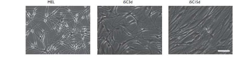 인체 색소세포의 분리와 iSCs의 교차분화 유도. 색소세포 (melanocyte)는 초대 배양시 mature pigmented melanocytes와 melanoblast가 동시에 배양되며, Schwann cell-inducing media에서 교차분화 유도하여 iSCs로 생성함.