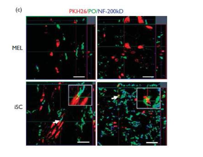 triple-staining된 세포의 confocal 분석을 통한 신경기능회복확인. 이식한 iSCs (PKH26)가 신경세포 (NH-200kDa)를 둘러싼 myelin sheath으로의 분화되었음을 확인하여 좌골신경 손상이 iSCs에 의해 기능적으로도 회복되었음.