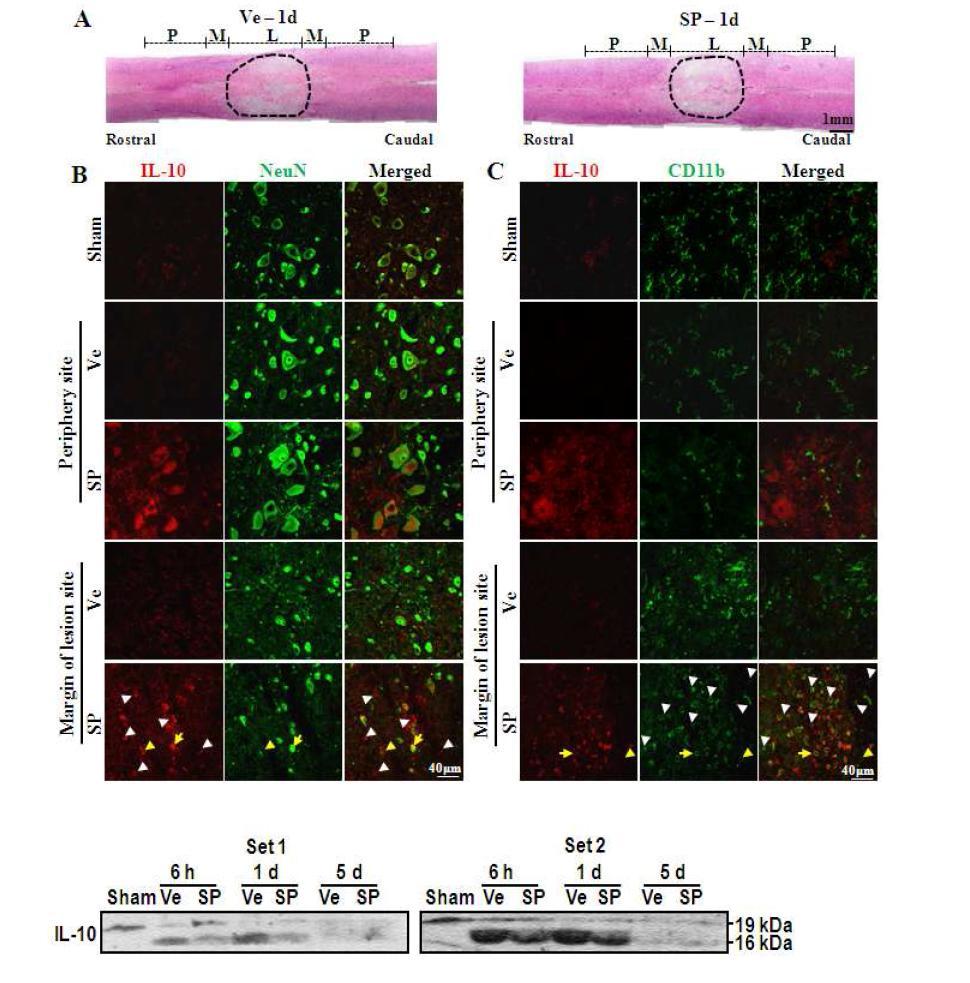 Substance-P 처리한 그룹 손상부위의 microglia 와 macrophage에서 IL-10 발현 증가하는 것이 관찰되 었음. (A) H&E 염색한 척수손상 section에서 조직 염색 및 관찰한 부위를 보여줌. (B와 C) 면역형광염색에서 IL-10은 NeuN 양성반응을 보여주는 신경세포와 CD11b 양성반응을 보여주는 염증세포 microglia 혹은 macrophage에서 발현함을 보여줌. Arrows는 이중 염색된 IL-10을 발현하는 신경세포와 염증세포를 보여주고arrowheads는 IL-10을 발현하지 않은 세포를 보여줌. IL-10을 발현하는 신경세포는 손상 부위 주변 혹은 가장자리에 많이 존재하고 CD11b 양성반응을 보여주고 부분적으로 IL-10을 발현하는 세포는 Substance-P를 처리한 그룹의 척수 손상 가장자리에서 많이 관찰되었음Substance-P 처리 후 척수 손상 조직의 항염증 cytokine IL-10 발현 변화의 분석하였음. Western 분석에서 선명한 IL-10 band가 관찰되었음.