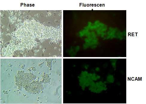 체외배양 과정중 자가증식 정원줄기세포에서 RET (c-Ret proto-oncogen)과 NCAM의 발현양상