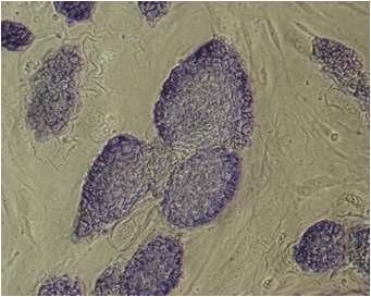다분화능 정원줄기세포의 ALP 활성 검사