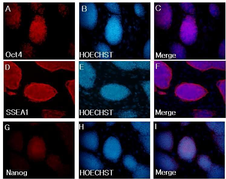 면역세포화학법을 통한 다분화능 정원줄기세포에서pluripotent 마커 유전자의 단백발현 양상.