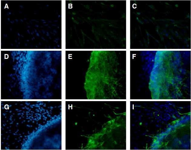 A), B), C): NF 발현양상. D), E), F): MAP2 발현양상. G), H), I): GFAP 발현양상. A), D), G): Hochest. B),E), H): green fluorescence. C), F), I): merge. 신경세포군으로 분화유도된 세포들로부터 신경세포군 특이적 유전자가발현함. 400X