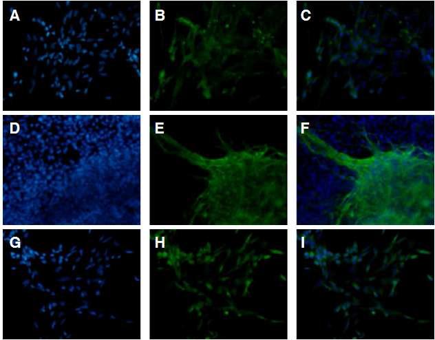 A), B), C): NF 발현양상. D), E), F): MAP2 발현양상. G), H), I): GFAP 발현양상. A), D), G): hochest. B),E), H): green fluorescence. C), F), I): merge. SHH를 이용하여 신경세포군으로 분화유도된 세포들로부터 신경세포군특이적 유전자가 발현함