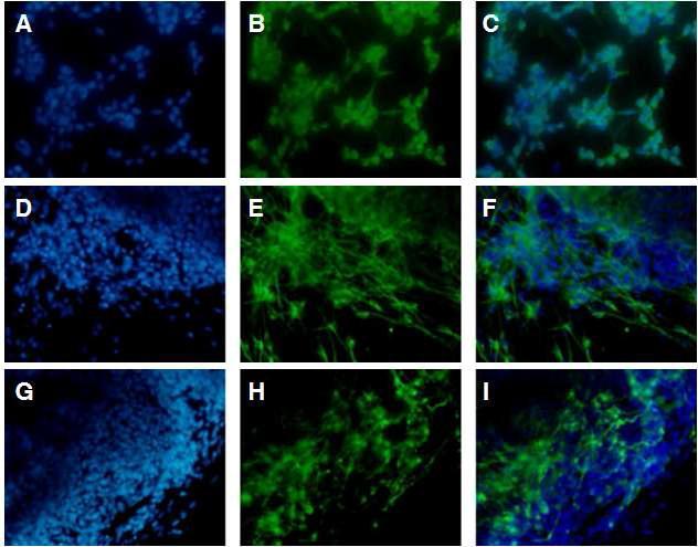 A), B), C): NF 발현양상. D), E), F): MAP2 발현양상. G), H), I): GFAP 발현양상. A), D), G): hochest. B),E), H): green fluorescence. C), F), I): merge. SHH 와FGF8의 병행처리하여 신경세포군으로 분화유도된 세포들로부터 신경세포군 특이적 유전자가 발현함