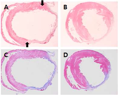 H&E 및 MT staining을 이용한 심장조직염색을 통한 이식된 세포의 조직 재생능 검증 A, B) H&E staining.C,D) MT staining. A, C) 좌전하행동맥을 결찰 4주후 적출된 대조군 심장. B, D) 좌전하행동맥 결찰과 함께 PDGFRa를 발현하는 세포군의 이식 4주후 적출된 심장. 화살표: 세포이식 부위