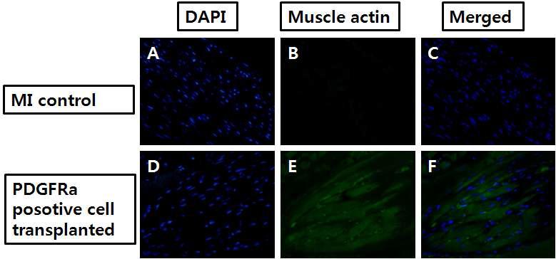 세포이식 후 면역조직화학법을 이용한 muscle actin 유전자의 발현검증. MI: Myocardial infarction(심근경색)