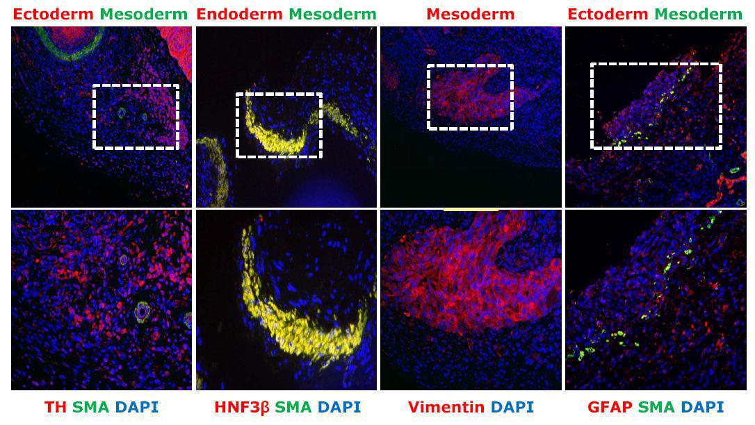 단일 세포 유래의 역분화 줄기세포주의 in vivo teratom형성 확인