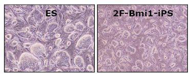 배아줄기세포와 역분화 줄기세포 (2F-Bmi1-iPS)의 morphology가 유사함을 비교 분석