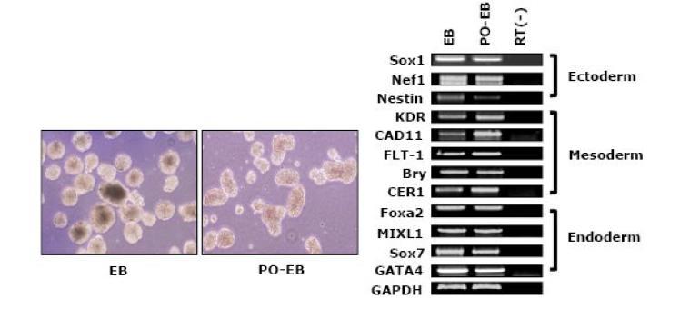 역분화 줄기세포가 embryonic body를 형성하는 것을 확인하고, 이 때 삼배엽에 해당하는 유전자들이 발현되는 것을 RT-PCR의 방법을 통해 확인함