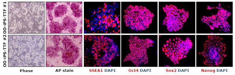 OO-iPS-TTF에서 배아줄기세포에서 대표적인 마커인 Oct4, Sox2, Nanog, SSEA1가 발현이 되는 것을 확인