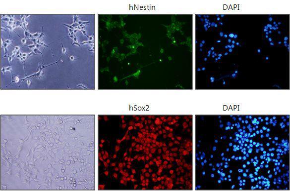특정 배양조건에서 확립된 세포주의 특성을 분석하기 위해 immunostaining을 통해 확인한 결과 NSC 특이적으로 발현하는 Nestin과 Sox2의 발현을 확인