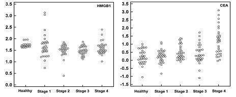 대장암 환자의 암 진단 시 TNM에 따른 평균 혈청 HMGB1과 CEA의 정량적 비교 증명