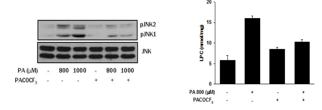 Attenuation of palmitic acid (PA)-induced insulin resistance by PACOCF3, an iPLA2 inhibitor (left). The increase of LPC after PA treatment was attenuated by PACOCF3.