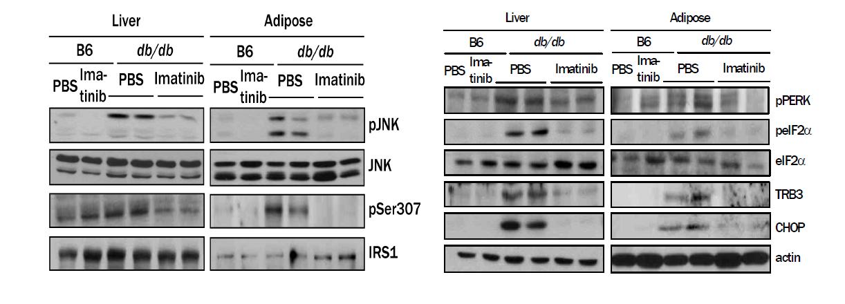 Gleevec 투여 후 insulin resistance 를 일으키는 molecular event 인 JNK phosphorylation, IRS-1 serine phosphorylation 이 감소하였음 (left). 한편 lipid injury에 의한 insulin resistance 의 주요 기전으로 생각되는 PERK, eIF2α, TRB3 등 ER stress marker의 activation 도 Gleevec 투여에 의하여 감소하였다 (right).