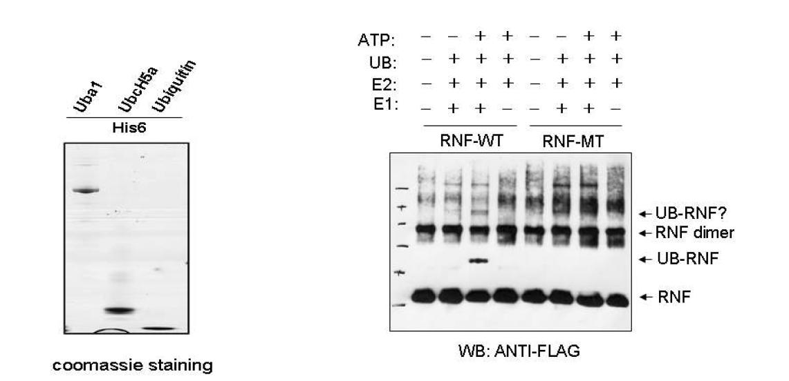 In vitro ubiquitination analysis에서 wild-type RNF170은 autoubiquitination 이 잘 되는 반면 RING finger domain mutant에서는 autoubiquitination 이 일어나지 않음을 보여 RNF170이 E3 ligase 일 가능성을 보여주었다.