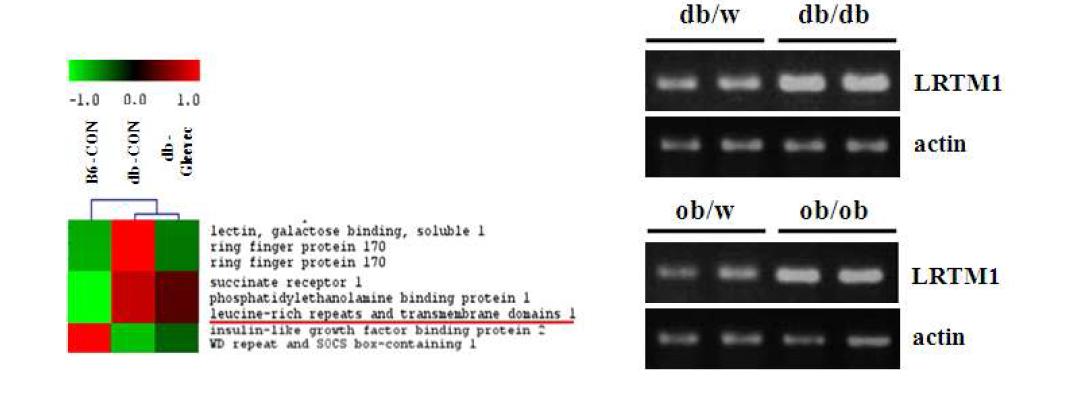 Increased expression of LRTM1 in tissues of obesity mouse models.