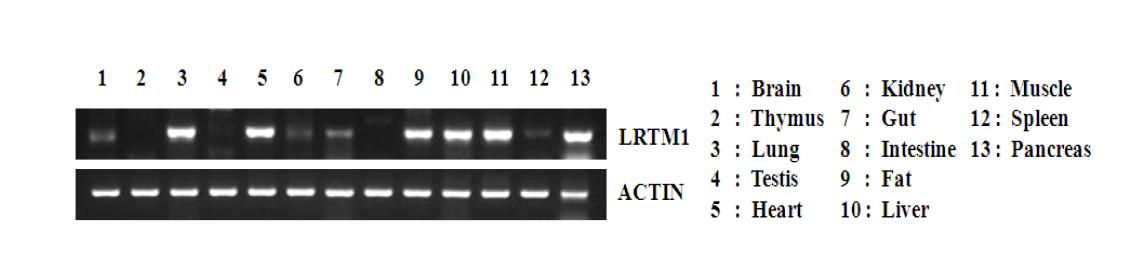 Expression of LRTM1 in various tissues.