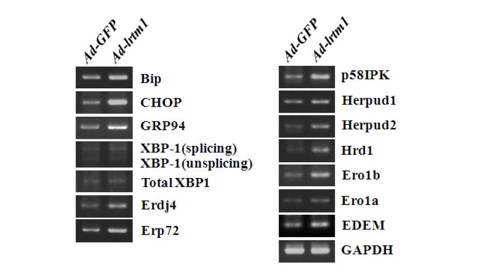 Effect of lrtm1 overexpression on UPR gene expression.