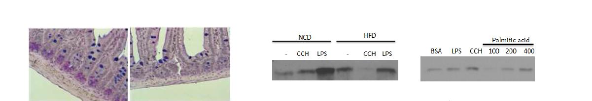 Alcian blue staining 한 결과 high-fat diet 후 파네트 세포내의 라이소자음 granule이 감소하였음 (left). Intestinal crypt 분리후 Western blot 시행시 lysozyme content가 in vivo high fat diet 또는 in vitro palmitic acid treatment 에 의해 감소함 (right).