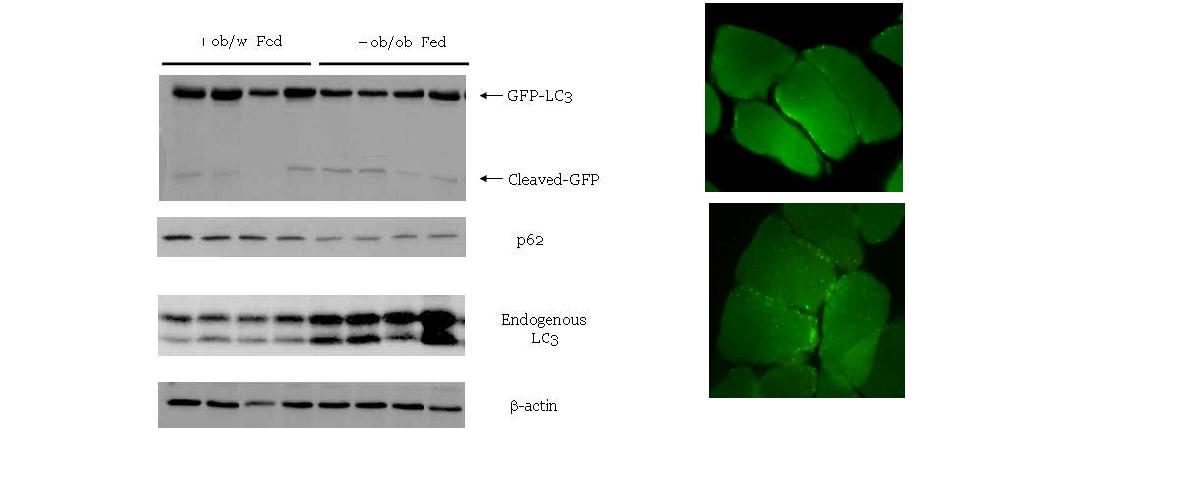 ob/ob mouse 및 GFP-LC3-transgenic ob/ob 마우스 muscle에서 endogenous LC3 II conversion, GFP-LC3 로부터 GFP의 cleavage 및 p62 의 변화를 본 Western blot 양상 (left).