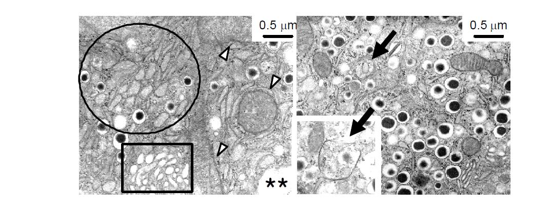 β-cell-specific Atg7 knockout 마우스(Atg7Δβ-cell)의 췌장소도세포에서는 insulin granule 이 감소되어 있었으며 (data not shown), mitochondria의 swelling (white arrow head), ER distention (circle), Golgi complex의 swelling (rectangle) 등이 관찰되었다 (left). Control 마우스의 췌장소도세포에서는 그러 한 변화가 없었으며 대신 double-membrane으로 싸인 autophagic vacuole이 관 찰되었다 (black arrow) (right).