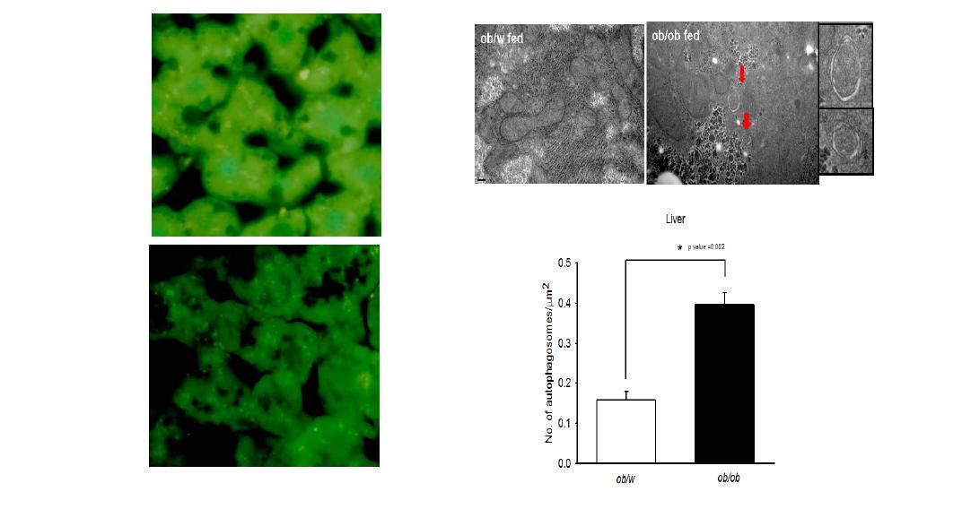 LC3 punta are visible in the liver of fed ob/ob mice (left upper) but not in that of control mice (left lower), suggesting increase steady-state autophagy level in obesity. Autophagosome number was increased in the liver of ob/ob mice by EM (right).