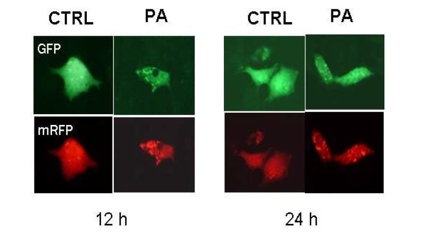 After treatment of HepG2 cells with palmitic acid, LC punta showing GFP was observed. mRFP fluorescence was also noted, that was resistance to the lysosomal proteases.