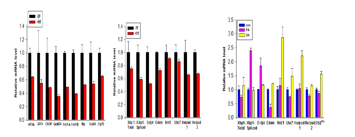 Real-time RT-PCR shows attenuated expression of URP genes in the Atg7-null pancreatic islets compared to wild-type islets (left). Expression of UPR genes after treatment of insulinoma cells with palmitic acid determined by real-time RT-PCR (right).