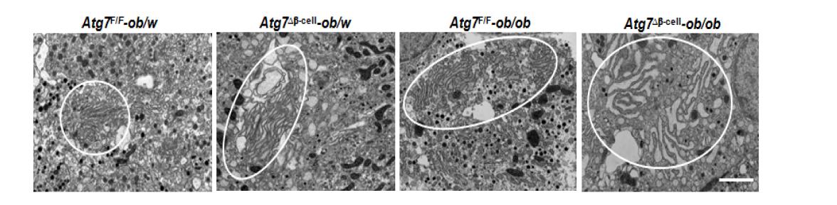 각 마우스에서 ER 의 morphology를 EM 으로 관찰함. Atg7b-cell-ob/ob 마우스에서 가장 심한 ER distention 을 보임.