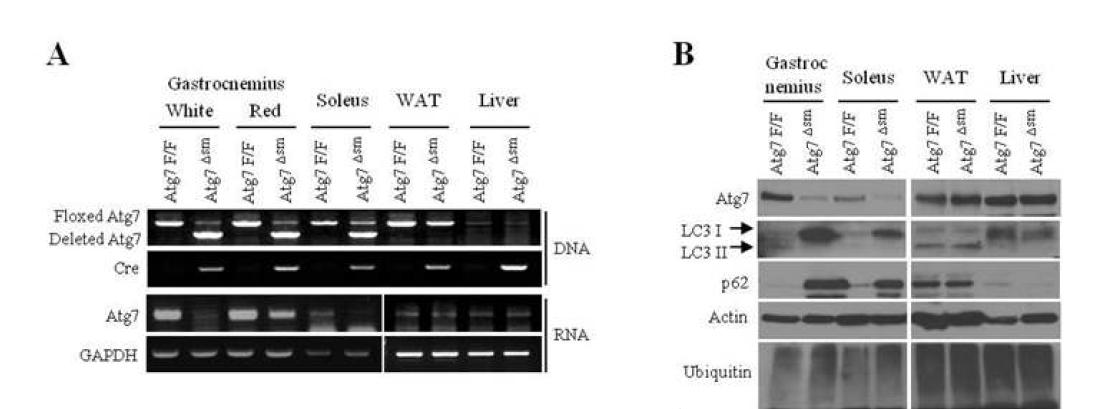 Skeletal muscle-specific Atg7 knockout mice (Atg7Δsm) 마우스의 제조. (A) While & red muscle에서 Atg7의 deletion이 특이적으로 나타나며 다른 organ에는 영향이 없음. Atg7 mRNA의 발현이 skeletal muscle에서 특이적으로 감소해 있음. (B) Control mouse에서는 fasting 으로 LC3-I 이 -II 로 conversion 되는 것이 관찰되나 Atg7Δsm 마우스에서는 그 현상이 일어나지 않으며 autophagy의 substrate인 p62는 축적되어 있음.