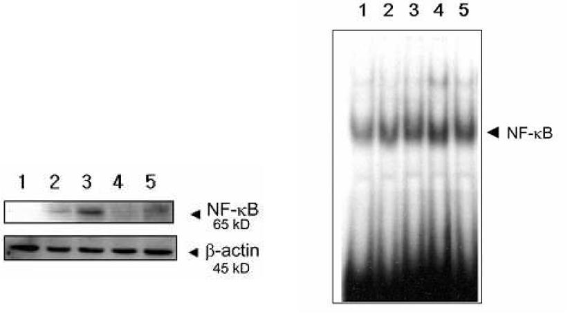 Effect of Ikmocho on NF-κB expression in macrophages