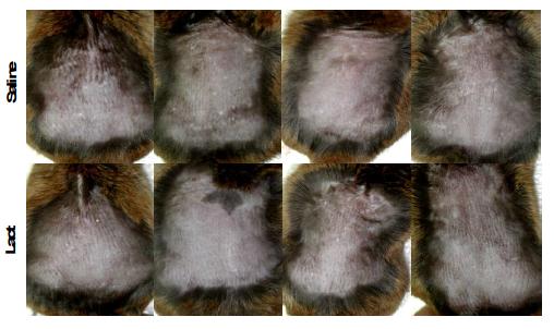Skin allergy-induced mice back-patch at 3 weeks of treatment.