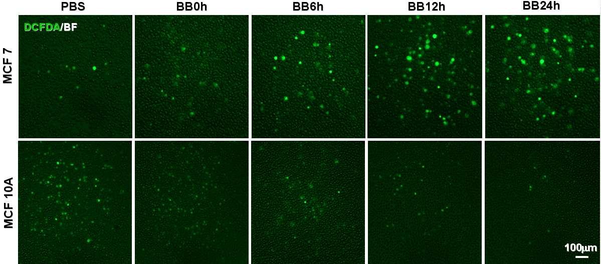 MCF7과 MCF10A 세포에서 BBE의 ROS 축적 효과.