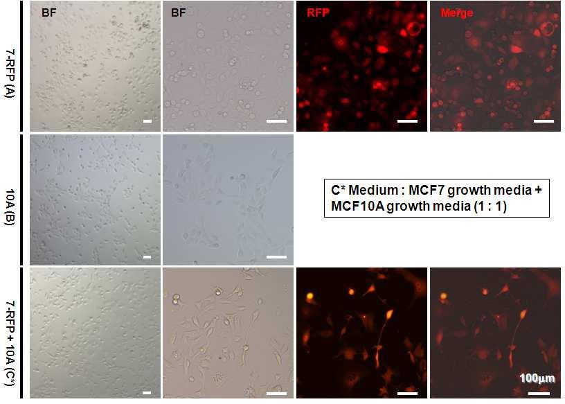 MCF7-RFP mutant 세포와 MCF10A 세포의 혼합 배양 중 In Vitro Assay.