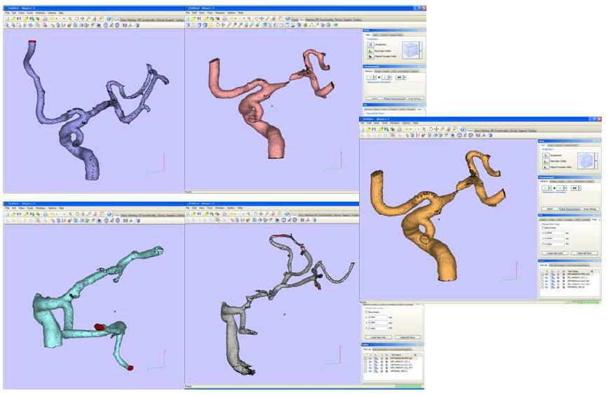 MRA, CTA 영상데이터를 활용한 개별환자들의 3D 모델 변환 결과